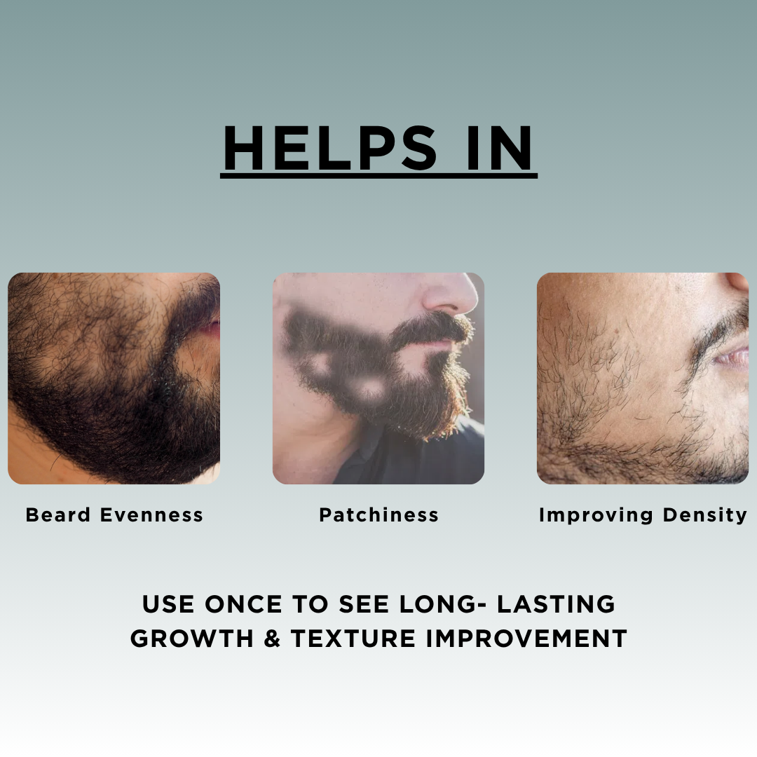 Fix Patchy Beard -Beard Fill and Grow